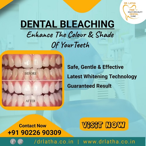 Keep Your Smile Bright With Two Shades Of Whiter Teeth Fine Dental Clinic Dr Latha 